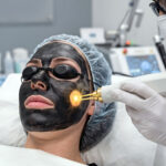 September ist Lasersaison: Warum Peeling und Laser im Herbst starten sollten