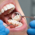 Oral Longevity: Warum gesundes Altern im Mund beginnt