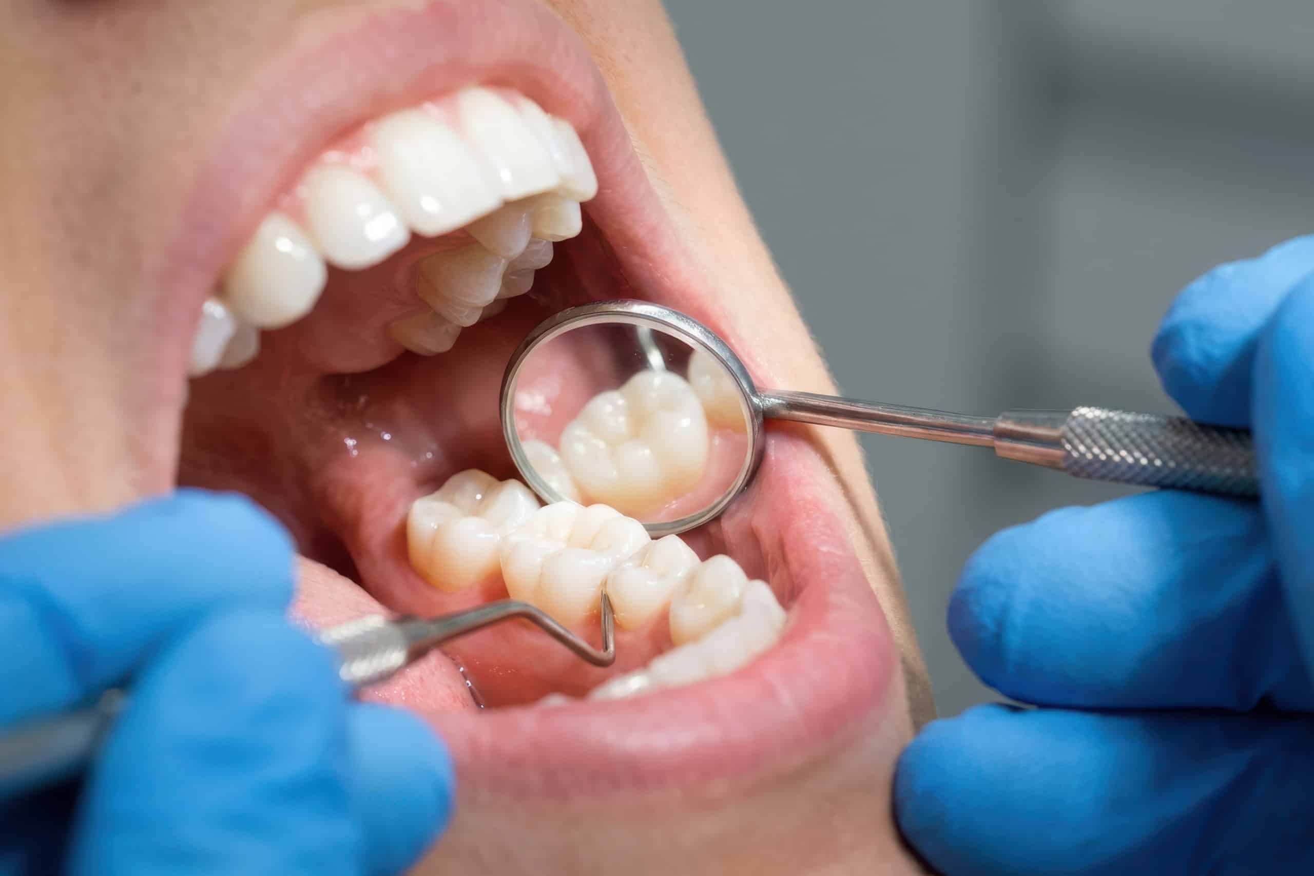 Oral Longevity: Warum gesundes Altern im Mund beginnt
