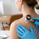 Melanom-Impfung: Was die erste Phase-3-Studie zur mRNA-Therapie zeigt